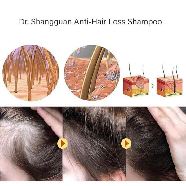 Anti Hair Loss Shampoo 200ML - Image 3