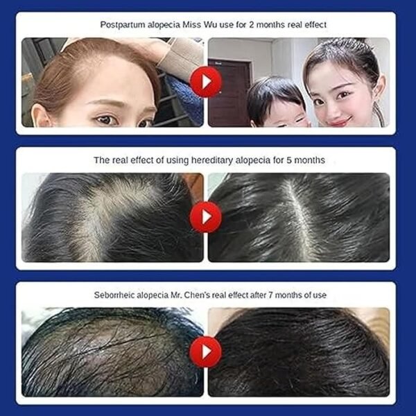 Anti Hair Loss Shampoo 200ML - Image 5